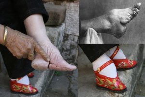 foot binding